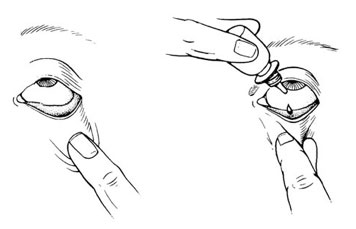 Eye Drops Diagram