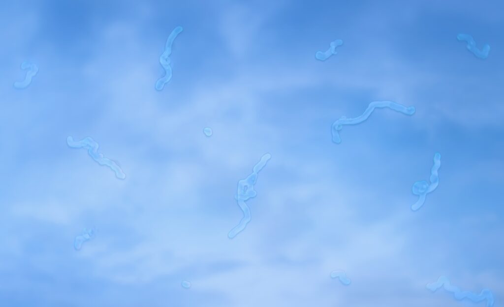 eye floaters