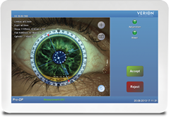 Verion Eye Imaging