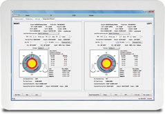 Verion Eye Imaging